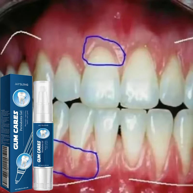 Damaged Gum Repair Care Gel Relieve Sore Gums Allergy Deep Cleaning Teeth Stains Tartar Serum Dental Caries Toothpaste