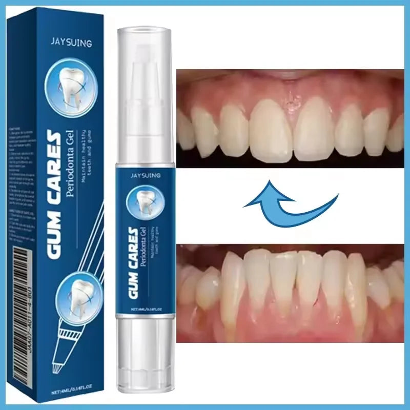 Damaged Gum Repair Care Gel Relieve Sore Gums Allergy Deep Cleaning Teeth Stains Tartar Serum Dental Caries Toothpaste